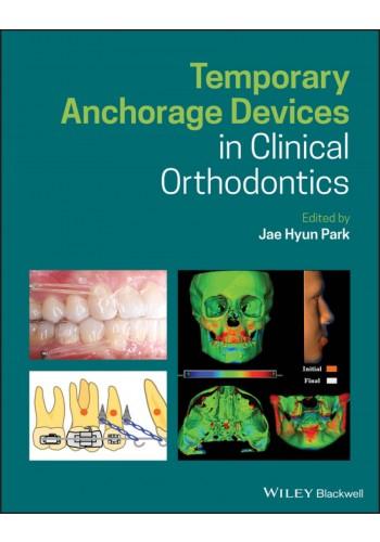 Temporary Anchorage Devices in Clinical Orthodontics 2020(نشر رویان پژوه)