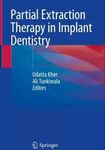 Partial Extraction Therapy in Implant Dentistry 2020(نشر رویان پژوه)