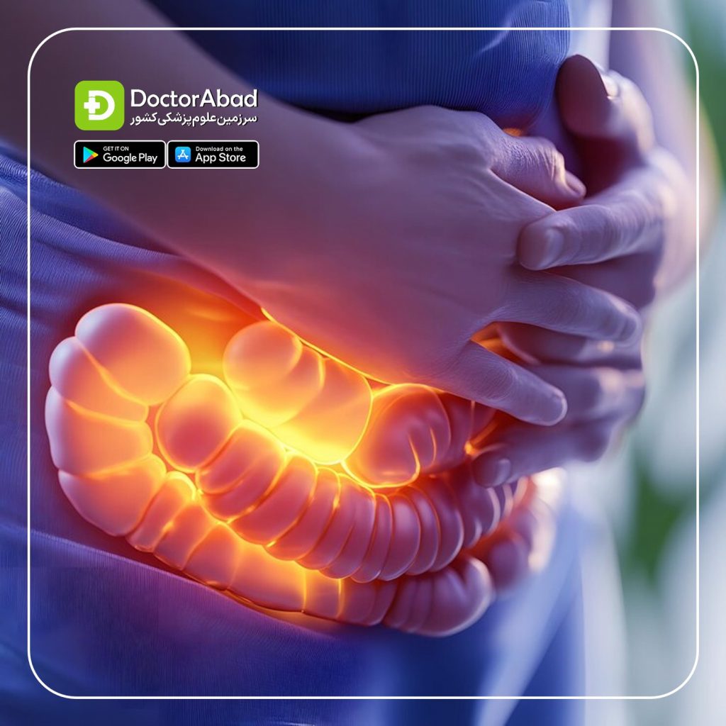 IBD؛ بیماری‌های التهابی روده (Inflammatory bowel disease) | دکترمگ دکترآباد