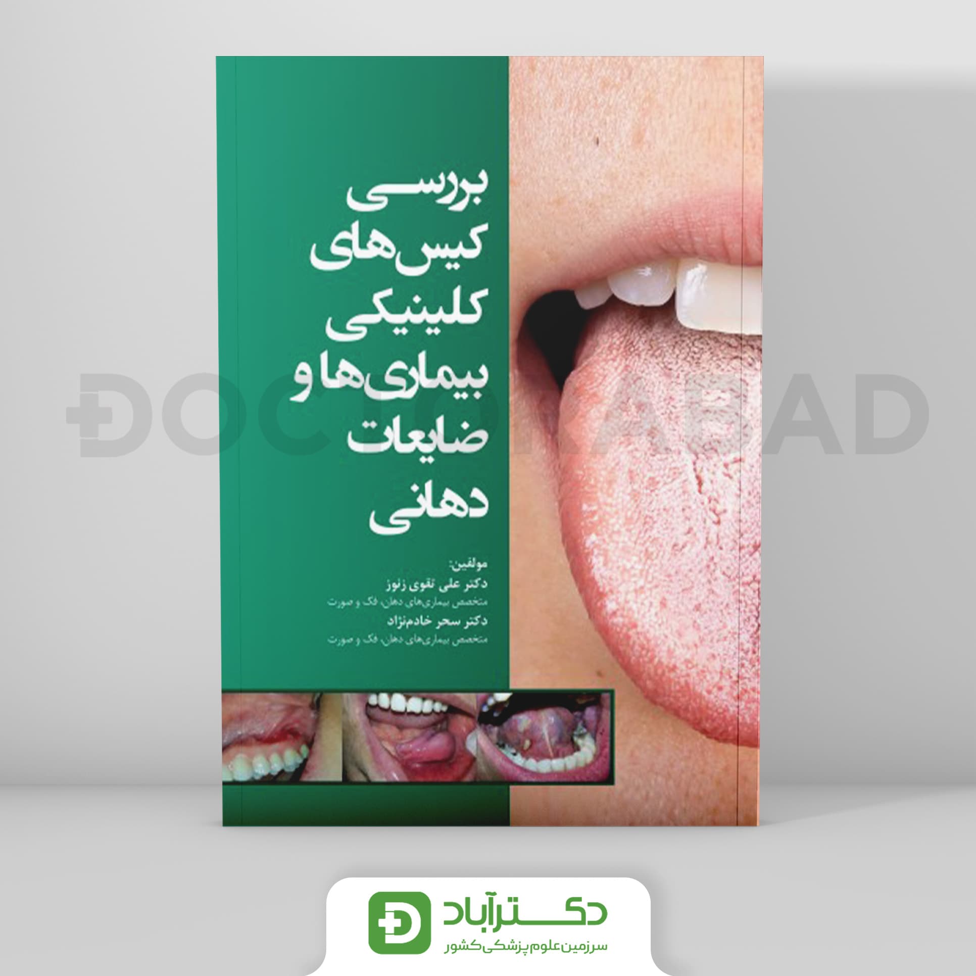 بررسی کیس های کلینیکی بیماریها و ضایعات دهانی (رویان پژوه)