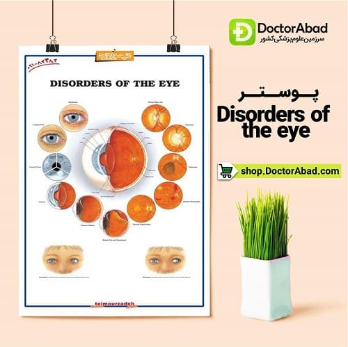 پوستر DISORDERS OF THE EYE