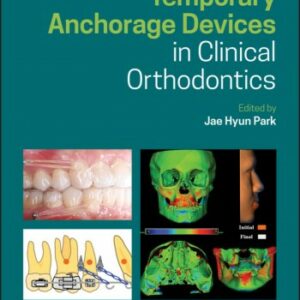 Temporary Anchorage Devices in Clinical Orthodontics 2020