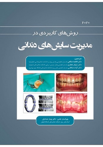 روش های کاربردی در مدیریت سایش های دندانی 2020