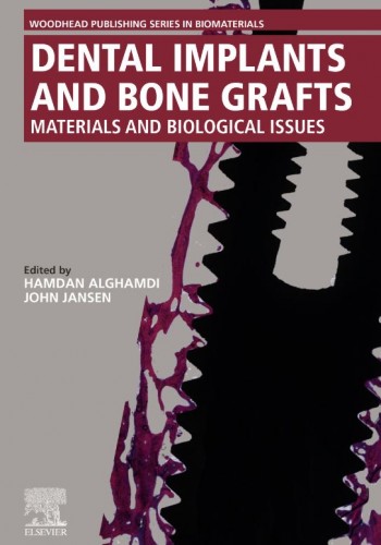 Dental Implants and Bone Grafts2020