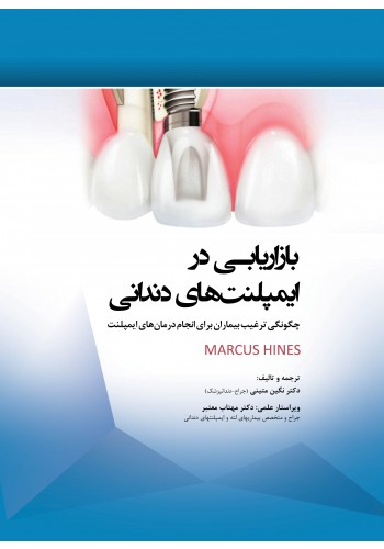 بازاریابی در ایمپلنت های دندانی چگونگی ترغیب بیماران برای انجام درمان های ایمپلنت